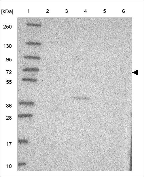 Lane 1: Marker [kDa] 250,130,95,72,55,36,28,17,10 Lane 2: RT4 Lane 3: U-251 MG Lane 4: Human Plasma Lane 5: Liver Lane 6: Tonsil