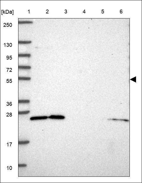 Lane 1: Marker [kDa] 250,130,95,72,55,36,28,17,10 Lane 2: RT4 Lane 3: U-251 MG Lane 4: Human Plasma Lane 5: Liver Lane 6: Tonsil