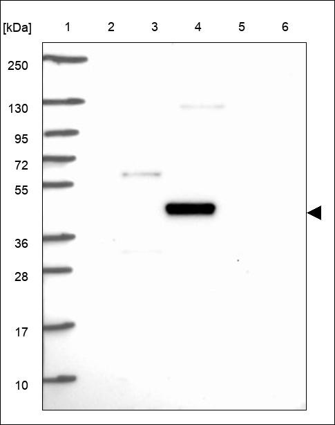 Lane 1: Marker [kDa] 250,130,95,72,55,36,28,17,10 Lane 2: RT4 Lane 3: U-251 MG Lane 4: Human Plasma Lane 5: Liver Lane 6: Tonsil