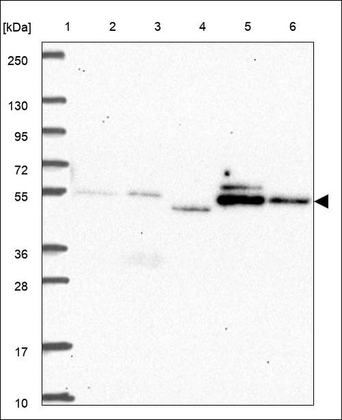 Lane 1: Marker [kDa] 250,130,95,72,55,36,28,17,10 Lane 2: RT4 Lane 3: U-251 MG Lane 4: Human Plasma Lane 5: Liver Lane 6: Tonsil