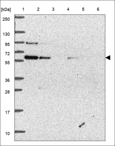 Lane 1: Marker [kDa] 250,130,95,72,55,36,28,17,10 Lane 2: RT4 Lane 3: U-251 MG Lane 4: Human Plasma Lane 5: Liver Lane 6: Tonsil