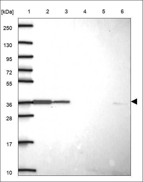 Lane 1: Marker [kDa] 250,130,95,72,55,36,28,17,10 Lane 2: RT4 Lane 3: U-251 MG Lane 4: Human Plasma Lane 5: Liver Lane 6: Tonsil