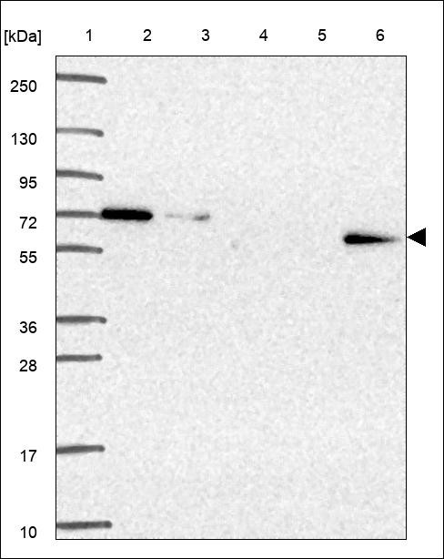 Lane 1: Marker [kDa] 250,130,95,72,55,36,28,17,10 Lane 2: RT4 Lane 3: U-251 MG Lane 4: Human Plasma Lane 5: Liver Lane 6: Tonsil