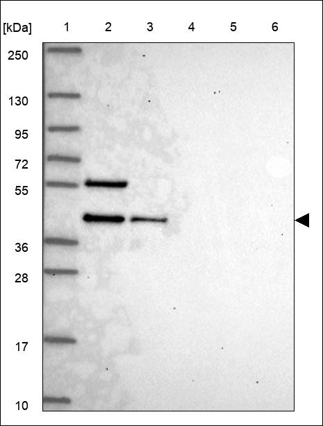 Lane 1: Marker [kDa] 250,130,95,72,55,36,28,17,10 Lane 2: RT4 Lane 3: U-251 MG Lane 4: Human Plasma Lane 5: Liver Lane 6: Tonsil