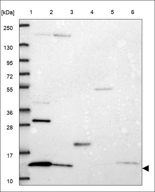 Lane 1: Marker [kDa] 250,130,95,72,55,36,28,17,10 Lane 2: RT4 Lane 3: U-251 MG Lane 4: Human Plasma Lane 5: Liver Lane 6: Tonsil