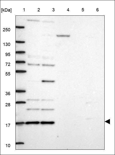 Lane 1: Marker [kDa] 250,130,95,72,55,36,28,17,10 Lane 2: RT4 Lane 3: U-251 MG Lane 4: Human Plasma Lane 5: Liver Lane 6: Tonsil