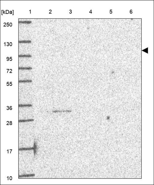 Lane 1: Marker [kDa] 250,130,95,72,55,36,28,17,10 Lane 2: RT4 Lane 3: U-251 MG Lane 4: Human Plasma Lane 5: Liver Lane 6: Tonsil