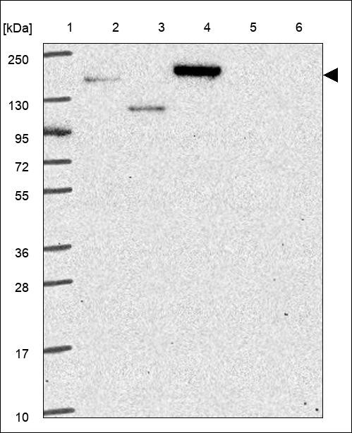 Lane 1: Marker [kDa] 250,130,95,72,55,36,28,17,10 Lane 2: RT4 Lane 3: U-251 MG Lane 4: Human Plasma Lane 5: Liver Lane 6: Tonsil