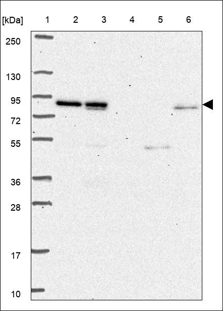 Lane 1: Marker [kDa] 250,130,95,72,55,36,28,17,10 Lane 2: RT4 Lane 3: U-251 MG Lane 4: Human Plasma Lane 5: Liver Lane 6: Tonsil