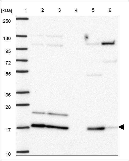 Lane 1: Marker [kDa] 250,130,95,72,55,36,28,17,10 Lane 2: RT4 Lane 3: U-251 MG Lane 4: Human Plasma Lane 5: Liver Lane 6: Tonsil