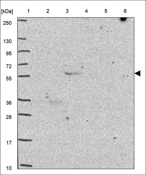 Lane 1: Marker [kDa] 250,130,95,72,55,36,28,17,10 Lane 2: RT4 Lane 3: U-251 MG Lane 4: Human Plasma Lane 5: Liver Lane 6: Tonsil