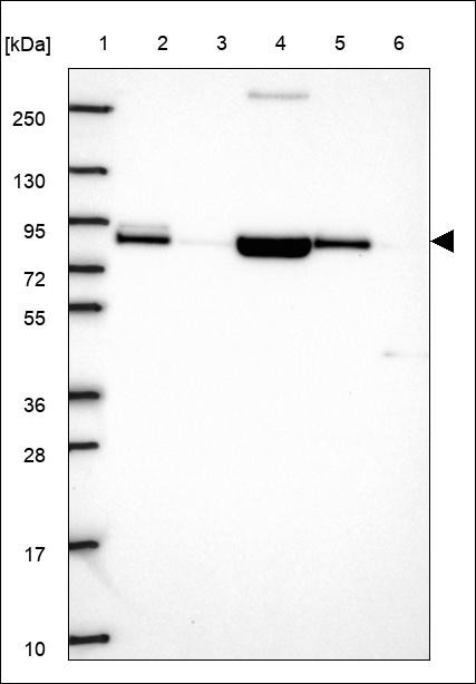 Lane 1: Marker [kDa] 250,130,95,72,55,36,28,17,10 Lane 2: RT4 Lane 3: U-251 MG Lane 4: Human Plasma Lane 5: Liver Lane 6: Tonsil