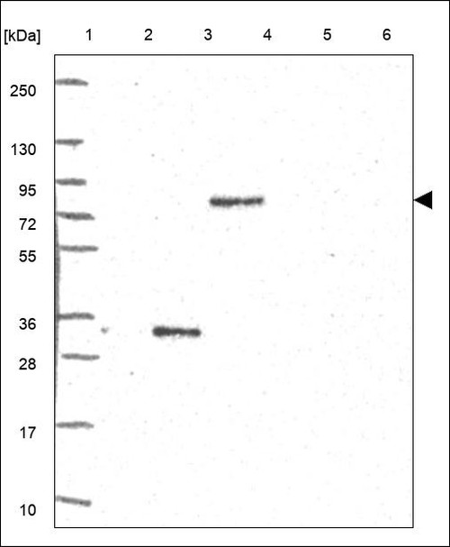 Lane 1: Marker [kDa] 250,130,95,72,55,36,28,17,10 Lane 2: RT4 Lane 3: U-251 MG Lane 4: Human Plasma Lane 5: Liver Lane 6: Tonsil