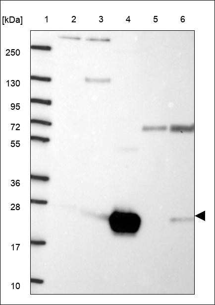 Lane 1: Marker [kDa] 250,130,95,72,55,36,28,17,10 Lane 2: RT4 Lane 3: U-251 MG Lane 4: Human Plasma Lane 5: Liver Lane 6: Tonsil