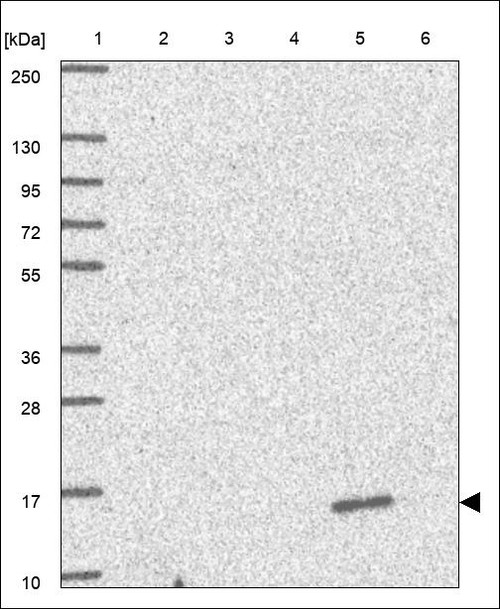Lane 1: Marker [kDa] 250,130,95,72,55,36,28,17,10 Lane 2: RT4 Lane 3: U-251 MG Lane 4: Human Plasma Lane 5: Liver Lane 6: Tonsil