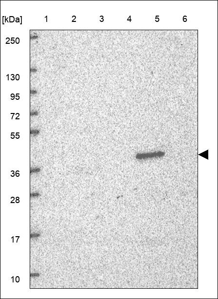 Lane 1: Marker [kDa] 250,130,95,72,55,36,28,17,10 Lane 2: RT4 Lane 3: U-251 MG Lane 4: Human Plasma Lane 5: Liver Lane 6: Tonsil