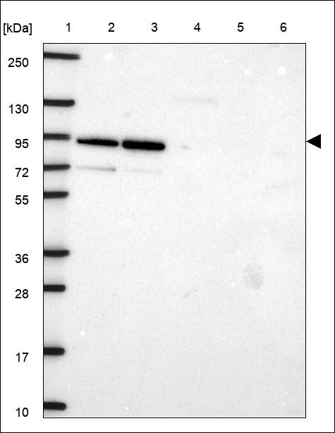 Lane 1: Marker [kDa] 250,130,95,72,55,36,28,17,10 Lane 2: RT4 Lane 3: U-251 MG Lane 4: Human Plasma Lane 5: Liver Lane 6: Tonsil
