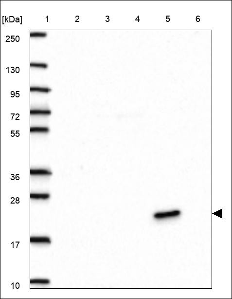 Lane 1: Marker [kDa] 250,130,95,72,55,36,28,17,10 Lane 2: RT4 Lane 3: U-251 MG Lane 4: Human Plasma Lane 5: Liver Lane 6: Tonsil