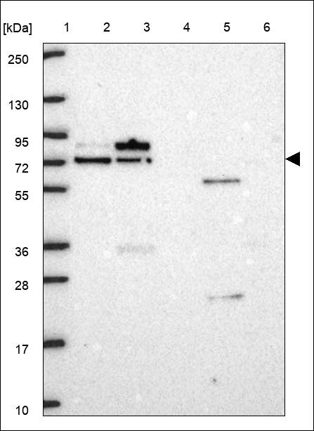Lane 1: Marker [kDa] 250,130,95,72,55,36,28,17,10 Lane 2: RT4 Lane 3: U-251 MG Lane 4: Human Plasma Lane 5: Liver Lane 6: Tonsil