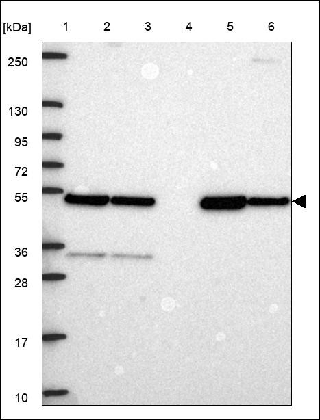 Lane 1: Marker [kDa] 250,130,95,72,55,36,28,17,10 Lane 2: RT4 Lane 3: U-251 MG Lane 4: Human Plasma Lane 5: Liver Lane 6: Tonsil