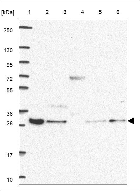 Lane 1: Marker [kDa] 250,130,95,72,55,36,28,17,10 Lane 2: RT4 Lane 3: U-251 MG Lane 4: Human Plasma Lane 5: Liver Lane 6: Tonsil