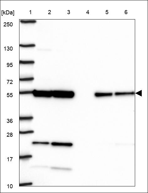 Lane 1: Marker [kDa] 250,130,95,72,55,36,28,17,10 Lane 2: RT4 Lane 3: U-251 MG Lane 4: Human Plasma Lane 5: Liver Lane 6: Tonsil