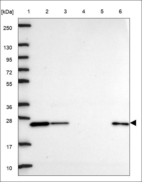 Lane 1: Marker [kDa] 250,130,95,72,55,36,28,17,10 Lane 2: RT4 Lane 3: U-251 MG Lane 4: Human Plasma Lane 5: Liver Lane 6: Tonsil