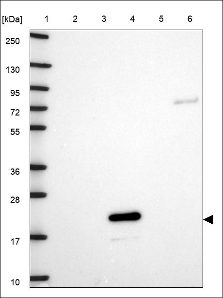 Lane 1: Marker [kDa] 250,130,95,72,55,36,28,17,10 Lane 2: RT4 Lane 3: U-251 MG Lane 4: Human Plasma Lane 5: Liver Lane 6: Tonsil