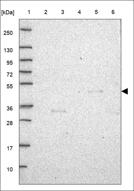 Lane 1: Marker [kDa] 250,130,95,72,55,36,28,17,10 Lane 2: RT4 Lane 3: U-251 MG Lane 4: Human Plasma Lane 5: Liver Lane 6: Tonsil