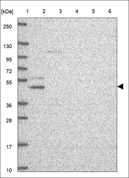 Lane 1: Marker [kDa] 250,130,95,72,55,36,28,17,10 Lane 2: RT4 Lane 3: U-251 MG Lane 4: Human Plasma Lane 5: Liver Lane 6: Tonsil