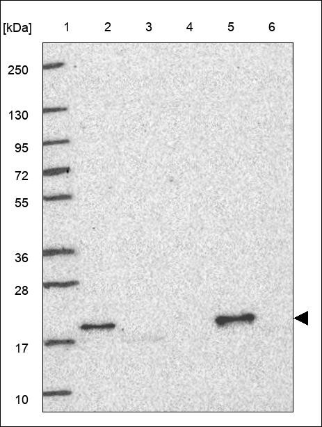 Lane 1: Marker [kDa] 250,130,95,72,55,36,28,17,10 Lane 2: RT4 Lane 3: U-251 MG Lane 4: Human Plasma Lane 5: Liver Lane 6: Tonsil