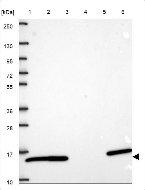 Lane 1: Marker [kDa] 250,130,95,72,55,36,28,17,10 Lane 2: RT4 Lane 3: U-251 MG Lane 4: Human Plasma Lane 5: Liver Lane 6: Tonsil