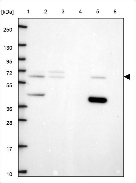 Lane 1: Marker [kDa] 250,130,95,72,55,36,28,17,10 Lane 2: RT4 Lane 3: U-251 MG Lane 4: Human Plasma Lane 5: Liver Lane 6: Tonsil