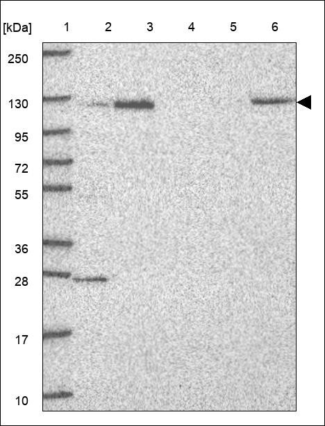 Lane 1: Marker [kDa] 250,130,95,72,55,36,28,17,10 Lane 2: RT4 Lane 3: U-251 MG Lane 4: Human Plasma Lane 5: Liver Lane 6: Tonsil