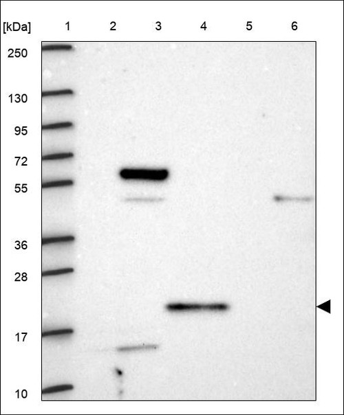 Lane 1: Marker [kDa] 250,130,95,72,55,36,28,17,10 Lane 2: RT4 Lane 3: U-251 MG Lane 4: Human Plasma Lane 5: Liver Lane 6: Tonsil