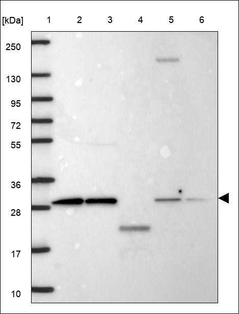 Lane 1: Marker [kDa] 250,130,95,72,55,36,28,17,10 Lane 2: RT4 Lane 3: U-251 MG Lane 4: Human Plasma Lane 5: Liver Lane 6: Tonsil