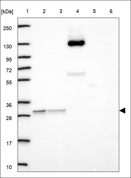 Lane 1: Marker [kDa] 250,130,95,72,55,36,28,17,10 Lane 2: RT4 Lane 3: U-251 MG Lane 4: Human Plasma Lane 5: Liver Lane 6: Tonsil