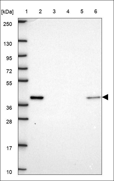 Lane 1: Marker [kDa] 250,130,95,72,55,36,28,17,10 Lane 2: RT4 Lane 3: U-251 MG Lane 4: Human Plasma Lane 5: Liver Lane 6: Tonsil