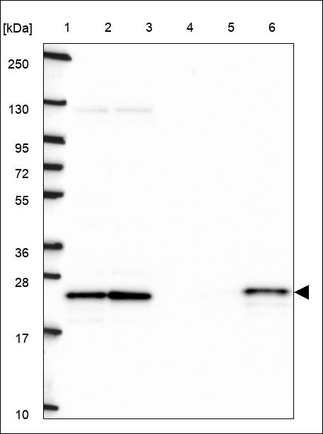 Lane 1: Marker [kDa] 250,130,95,72,55,36,28,17,10 Lane 2: RT4 Lane 3: U-251 MG Lane 4: Human Plasma Lane 5: Liver Lane 6: Tonsil