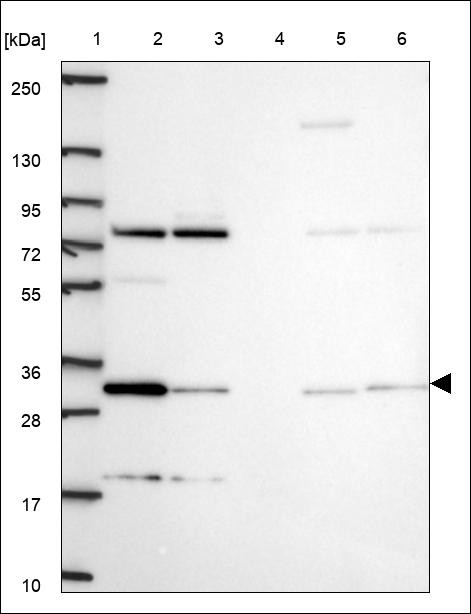 Lane 1: Marker [kDa] 250,130,95,72,55,36,28,17,10 Lane 2: RT4 Lane 3: U-251 MG Lane 4: Human Plasma Lane 5: Liver Lane 6: Tonsil