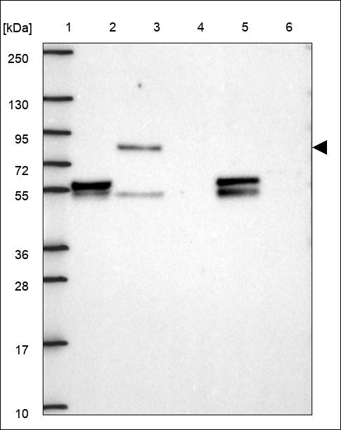 Lane 1: Marker [kDa] 250,130,95,72,55,36,28,17,10 Lane 2: RT4 Lane 3: U-251 MG Lane 4: Human Plasma Lane 5: Liver Lane 6: Tonsil