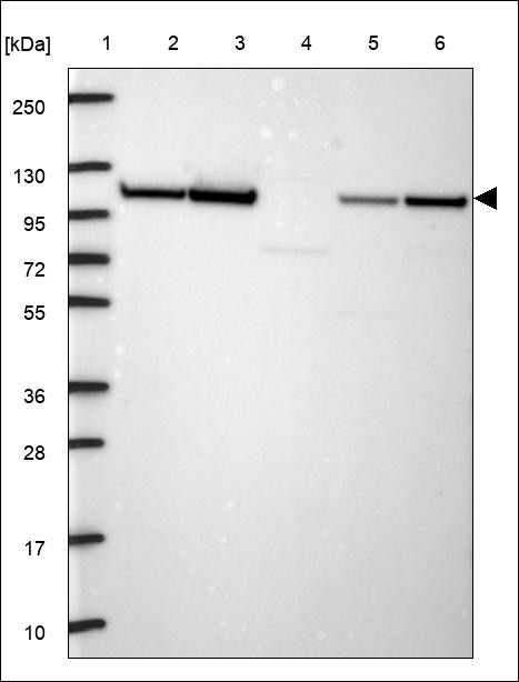 Lane 1: Marker [kDa] 250,130,95,72,55,36,28,17,10 Lane 2: RT4 Lane 3: U-251 MG Lane 4: Human Plasma Lane 5: Liver Lane 6: Tonsil