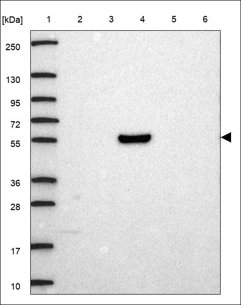 Lane 1: Marker [kDa] 250,130,95,72,55,36,28,17,10 Lane 2: RT4 Lane 3: U-251 MG Lane 4: Human Plasma Lane 5: Liver Lane 6: Tonsil