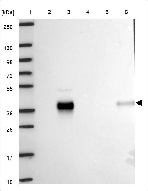 Lane 1: Marker [kDa] 250,130,95,72,55,36,28,17,10 Lane 2: RT4 Lane 3: U-251 MG Lane 4: Human Plasma Lane 5: Liver Lane 6: Tonsil