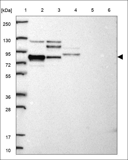 Lane 1: Marker [kDa] 250,130,95,72,55,36,28,17,10 Lane 2: RT4 Lane 3: U-251 MG Lane 4: Human Plasma Lane 5: Liver Lane 6: Tonsil