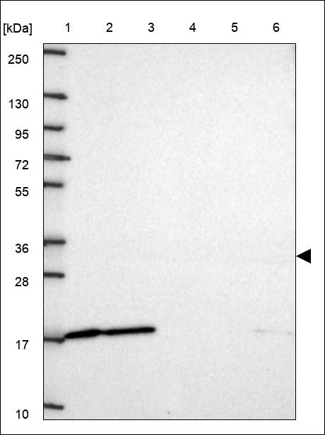 Lane 1: Marker [kDa] 250,130,95,72,55,36,28,17,10 Lane 2: RT4 Lane 3: U-251 MG Lane 4: Human Plasma Lane 5: Liver Lane 6: Tonsil