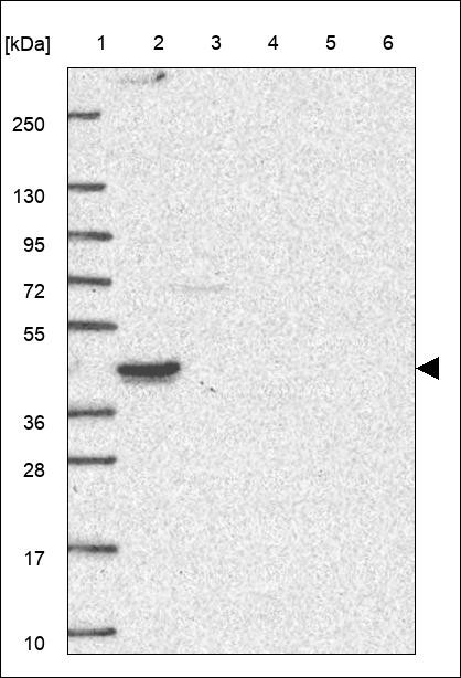 Lane 1: Marker [kDa] 250,130,95,72,55,36,28,17,10 Lane 2: RT4 Lane 3: U-251 MG Lane 4: Human Plasma Lane 5: Liver Lane 6: Tonsil