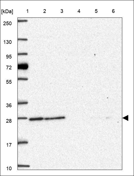 Lane 1: Marker [kDa] 250,130,95,72,55,36,28,17,10 Lane 2: RT4 Lane 3: U-251 MG Lane 4: Human Plasma Lane 5: Liver Lane 6: Tonsil