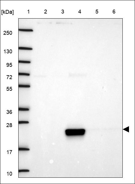 Lane 1: Marker [kDa] 250,130,95,72,55,36,28,17,10 Lane 2: RT4 Lane 3: U-251 MG Lane 4: Human Plasma Lane 5: Liver Lane 6: Tonsil