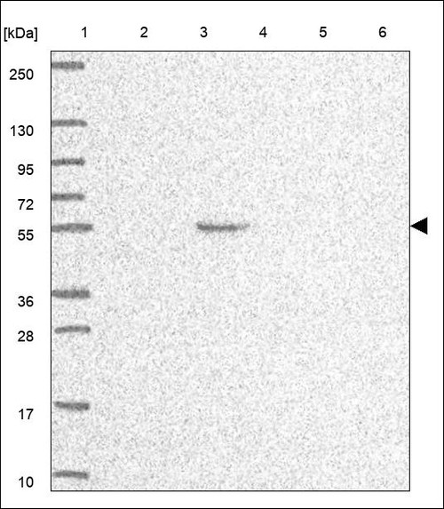 Lane 1: Marker [kDa] 250,130,95,72,55,36,28,17,10 Lane 2: RT4 Lane 3: U-251 MG Lane 4: Human Plasma Lane 5: Liver Lane 6: Tonsil